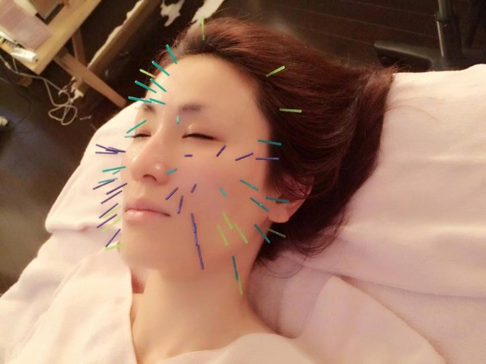 Acute Acute